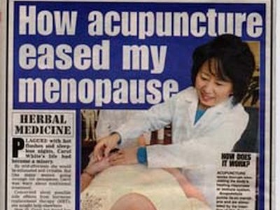 How acupuncture eased my menopause The Daily Echo dated Tuesday 1st February 2005